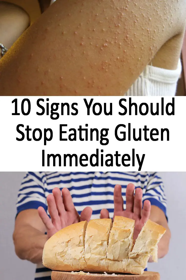 10 Signs You Should Stop Eating Gluten Immediately