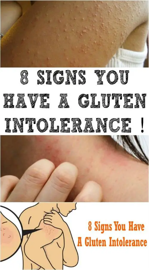 8 SIGNS YOU HAVE A GLUTEN INTOLERANCE !