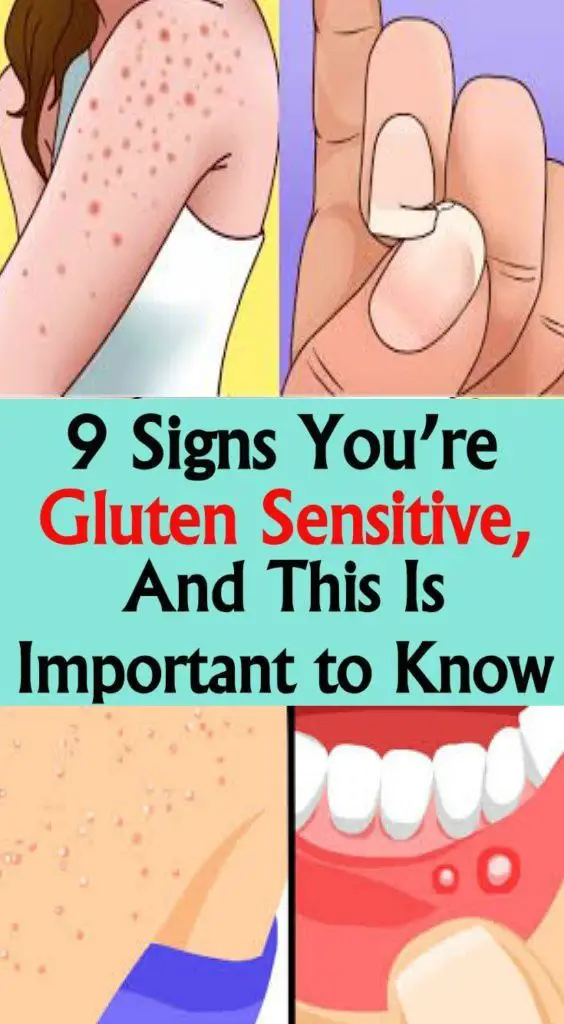 9 Signs Youre Gluten Sensitive, and This Is Important to Know ...