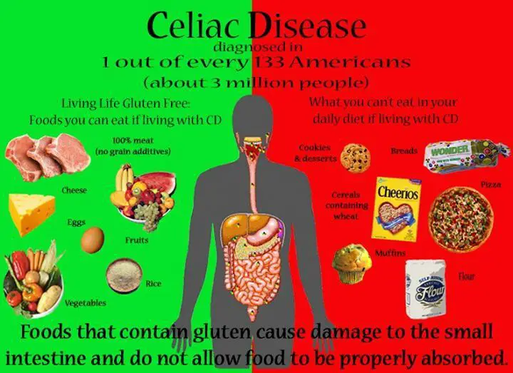 #Celiac #infographic of what is &  is not allowable to ingest in regard ...