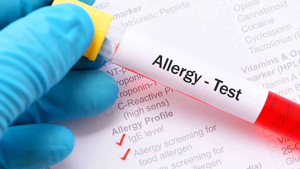 Food allergy and intolerance tests