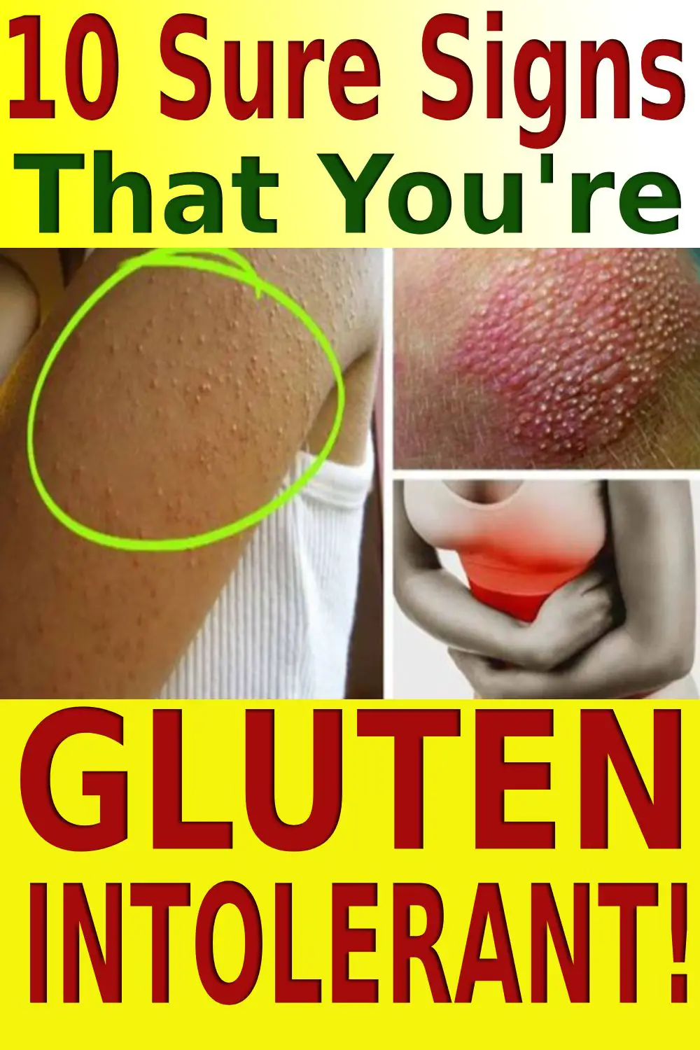 gluten intolerance gluten sensitivity healthy life
